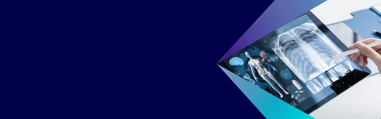 GenAI e industria farmacéutica